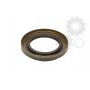 Garnitura diferential