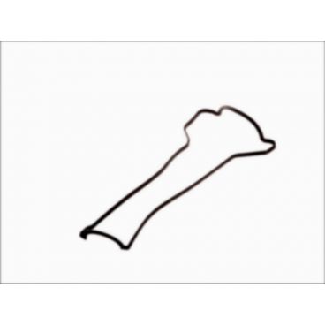 Garnitura capac culbutor