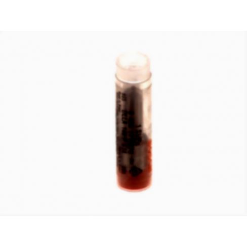 Duza injector conventional