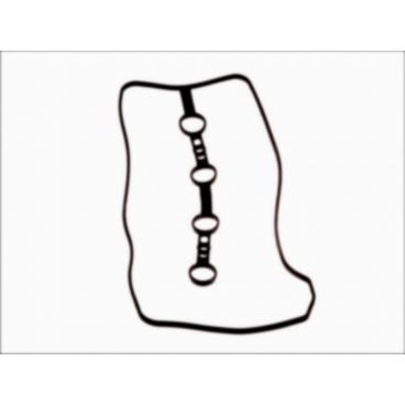 Garnitura capac culbutor